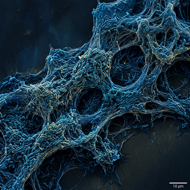 High-Resolution Microscopy of Bacterial Biofilm